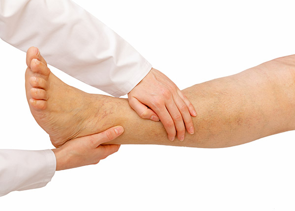 A New Jersey Vein Specialist on Why Varicose Veins Sometimes Come Back